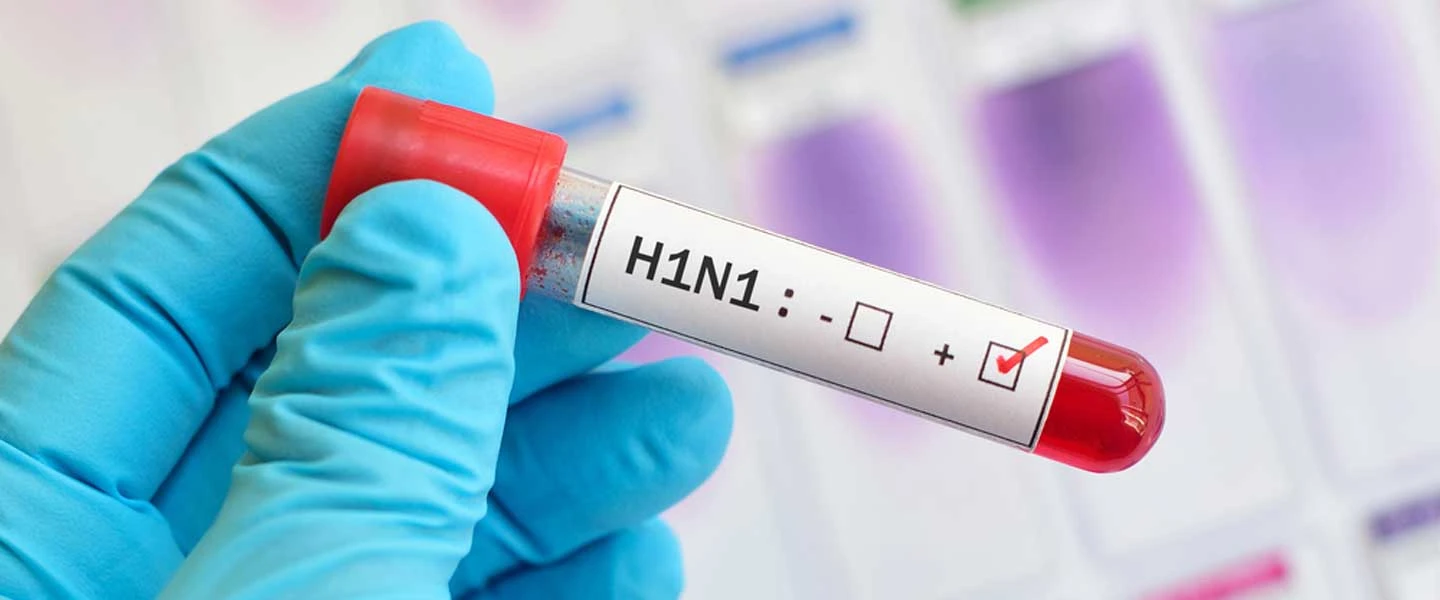 Domuz Gribi veya H1N1 (2009-2010)